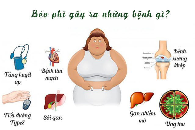 Người bị béo phì có nguy cơ mắc nhiều bệnh nguy hiểm