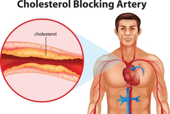 Dùng 1 gram tảo xoắn mỗi ngày có thể làm giảm tổng lượng cholesterol tới 16% khi dùng trong 12 tuần